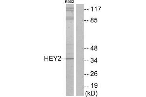 Western Blotting (WB) image for anti-Hairy/enhancer-of-Split Related with YRPW Motif 2 (HEY2) (Internal Region) antibody (ABIN1850038) (HEY2 抗体  (Internal Region))