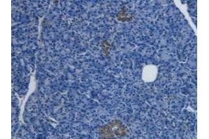 Detection of EDN1 in Human Pancreas Cancer Tissue using Monoclonal Antibody to Endothelin 1 (EDN1)