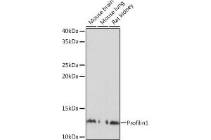 Western blot analysis of extracts of various cell lines, using Profilin1 Polyclonal Antibody (ABIN3021598, ABIN3021599, ABIN3021600 and ABIN6215334) at 1:500 dilution. (PFN1 抗体  (AA 1-140))