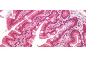 Detection of AXIN2 in Human Small Intestine Tissue using Polyclonal Antibody to Axis Inhibition Protein 2 (AXIN2) (AXIN2 抗体  (AA 350-631))