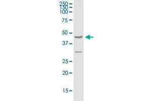 Western Blotting (WB) image for anti-G Protein-Coupled Receptor, Family C, Group 5, Member A (GPRC5A) (AA 1-357) antibody (ABIN522489)