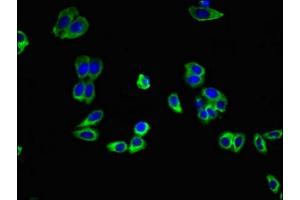 Immunofluorescent analysis of HepG2 cells using ABIN7143426 at dilution of 1:100 and Alexa Fluor 488-congugated AffiniPure Goat Anti-Rabbit IgG(H+L) (Adiponectin Receptor 1 抗体  (AA 1-63))