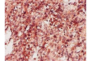 Immunostaining (ISt) image for anti-Ketohexokinase (KHK) (AA 1-298) antibody (ABIN561591)
