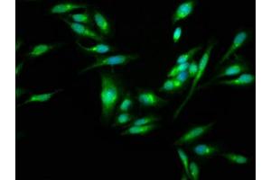 Immunofluorescence staining of Hela cells with ABIN7170595 at 1:100, counter-stained with DAPI. (SKA3 抗体  (AA 101-195))