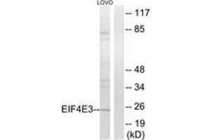 Western blot analysis of extracts from LOVO cells, using EIF4E3 Antibody. (EIF4E3 抗体  (AA 141-190))