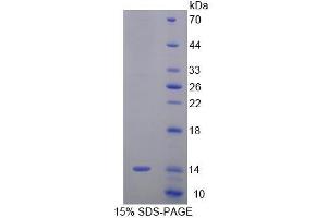 SDS-PAGE analysis of Mouse SRP9 Protein. (SRP9 蛋白)