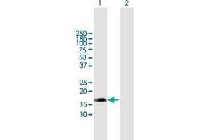 Western Blot analysis of EDN2 expression in transfected 293T cell line by EDN2 MaxPab polyclonal antibody. (Endothelin 2 抗体  (AA 1-178))