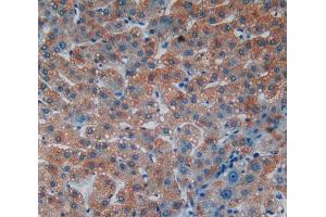 IHC-P analysis of liver tissue, with DAB staining. (Laminin alpha 1 抗体  (AA 2613-2746))