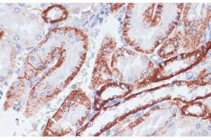 Immunohistochemistry of paraffin-embedded Rat kidney using TFRC Polyclonal Antibody at dilution of 1:100 (40x lens). (Transferrin Receptor 抗体)