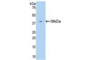 Western blot analysis of recombinant Human LDHB. (LDHB 抗体  (AA 1-334))