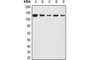 Western blot analysis of BOC expression in A431 (A), Hela (B), mouse lung (C), mouse brain (D), rat spinal cord (E) whole cell lysates. (BOC 抗体)