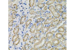 Immunohistochemistry of paraffin-embedded Mouse kidney using GLA Polyclonal Antibody at dilution of 1:100 (40x lens). (GLA 抗体)