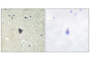 Immunohistochemistry (IHC) image for anti-Colony Stimulating Factor 1 Receptor (CSF1R) (Tyr809) antibody (ABIN1848010) (CSF1R 抗体  (Tyr809))