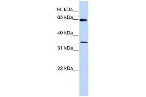 GTF2B antibody used at 0. (GTF2B 抗体  (C-Term))