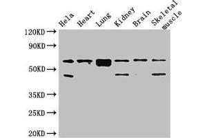 Western Blot Positive WB detected in: Hela whole cell lysate, Mouse heart tissue, Mouse lung tissue, Mouse kidney tissue, Mouse brain tissue, Mouse skeletal muscle tissue All lanes: PRKAA2 antibody at 2. (PRKAA2 抗体  (Catalytic Subunit alpha))