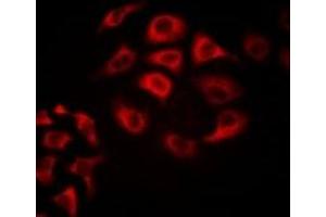 Immunofluorescent analysis of Tetranectin staining in Hela cells. (CLEC3B 抗体)