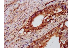Immunohistochemistry (IHC) image for anti-Protein tyrosine Phosphatase, Non-Receptor Type 3 (PTPN3) (AA 365-505) antibody (ABIN7174107)