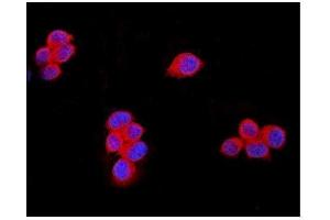 IF analysis of TRPM7 using anti-TRPM7 antibody (ABIN6719305).