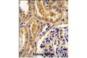 TLL2 Antibody (Center) (ABIN655266 and ABIN2844859) immunohistochemistry analysis in formalin fixed and paraffin embedded human kidney tissue followed by peroxidase conjugation of the secondary antibody and DAB staining. (Tolloid-Like 2 抗体  (AA 298-328))