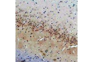 Immunohistochemical analysis of CACNG2 staining in rat brain formalin fixed paraffin embedded tissue section. (Stargazin 抗体)