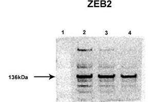 Western Blotting (WB) image for anti-Zinc Finger E-Box Binding Homeobox 2 (ZEB2) (Middle Region) antibody (ABIN2780948)
