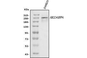 Western blot analysis of MRP4 using anti-MRP4 antibody (ABIN5518719).