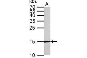 WB Image CDA antibody detects CDA protein by Western blot analysis. (CDA 抗体)
