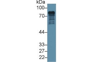 Western Blotting (WB) image for anti-Epsin 1 (EPN1) (AA 279-437) antibody (ABIN7442069)