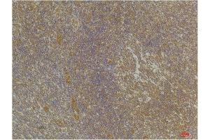 Immunohistochemistry (IHC) analysis of paraffin-embedded Human Tonsil Tissue using CXCR4 Rabbit Polyclonal Antibody diluted at 1:200. (CXCR4 抗体)