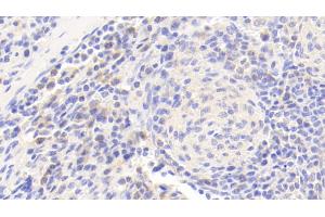 Detection of JNK1 in Human Spleen Tissue using Polyclonal Antibody to c-Jun N-terminal Kinase 1 (JNK1) (C-Jun N-Terminal Kinases (AA 145-419) 抗体)