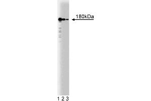 Western blot analysis of Clathrin Heavy Chain on HeLa cell lysate (center). (Clathrin 抗体  (AA 4-171))
