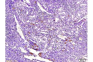 Formalin-fixed and paraffin embedded mouse endometrium tissue labeled with Anti-ECM1 Polyclonal Antibody, Unconjugated (ABIN673071) at 1:300, followed by conjugation to the secondary antibody and DAB staining