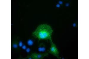 Anti-FAM84B mouse monoclonal antibody (ABIN2453036) immunofluorescent staining of COS7 cells transiently transfected by pCMV6-ENTRY FAM84B (RC207996). (FAM84B 抗体)