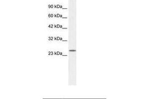 ZFAND6 抗体  (AA 125-174)