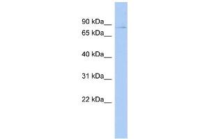 WB Suggested Anti-PHF17 Antibody Titration:  0. (PHF17 抗体  (Middle Region))