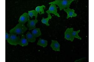 Immunofluorescence staining of A549 cells with ABIN7170322 at 1:50, counter-stained with DAPI. (SOS2 抗体  (AA 187-404))