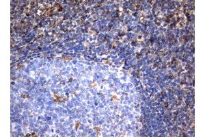 Image no. 2 for anti-Vimentin (VIM) (AA 210-466) antibody (ABIN1491200) (Vimentin 抗体  (AA 210-466))