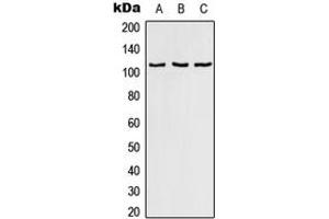 Western blot analysis of RAB3GAP1 expression in HeLa (A), SP2/0 (B), PC12 (C) whole cell lysates. (RAB3GAP1 抗体  (Center))