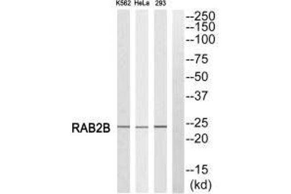 RAB2B 抗体