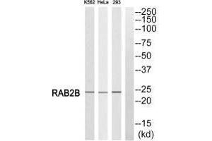 Western blot analysis of extracts from K562 cells, HeLa cells and 293 cells, using RAB2B antibody. (RAB2B 抗体)