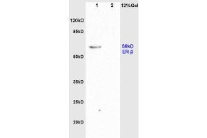 L1 rat brain, L2 rat colon lysates probed  at 1:200 in 4˚C. (Estrogen Receptor alpha + beta (AA 201-300) 抗体)