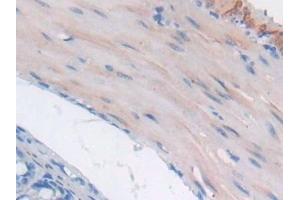Detection of GaA in Mouse Small intestine Tissue using Polyclonal Antibody to Glucosidase Alpha, Acid (GaA) (GAA 抗体  (AA 755-953))