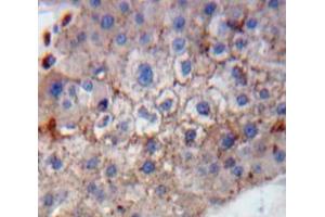 Used in DAB staining on fromalin fixed paraffin-embedded Liver tissue (GP1BB 抗体  (AA 53-176))