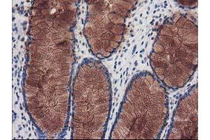 Immunohistochemical staining of paraffin-embedded Human colon tissue using anti-KATNB1 mouse monoclonal antibody. (KATNB1 抗体)