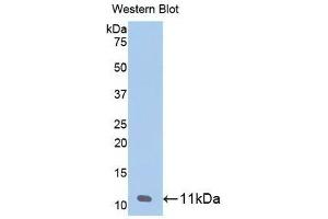 Detection of recombinant CXCL7 using Monoclonal Antibody to Chemokine (C-X-C motif) ligand 7 ( CXCL7) (CXCL7 抗体  (AA 59-128))