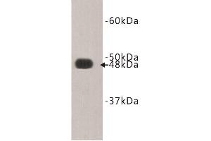 Western Blotting (WB) image for anti-FAT Tumor Suppressor Homolog 4 (FAT4) antibody (ABIN1854894)