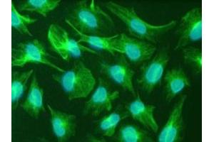 Immunfluorescence staining of the human glioma cell line U251. (Nestin 抗体)