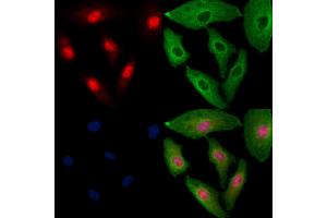 ABIN6257379 and ABIN6273550 staining  cells by IF/ICC.