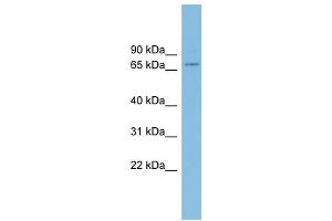 EIF4B antibody used at 1 ug/ml to detect target protein. (EIF4B 抗体  (Middle Region))