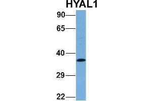 Host:  Rabbit  Target Name:  HYAL1  Sample Type:  Human Fetal Lung  Antibody Dilution:  1. (HYAL1 抗体  (N-Term))